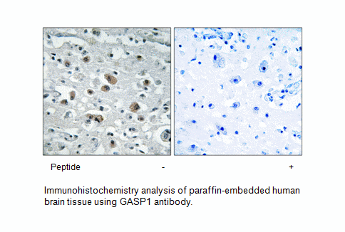 Product image for GASP1 Antibody