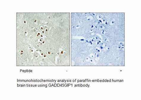 Product image for GADD45GIP1 Antibody