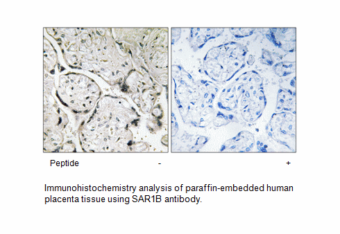 Product image for SAR1B Antibody