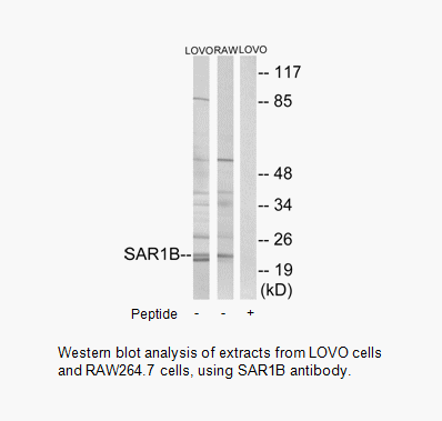 Product image for SAR1B Antibody