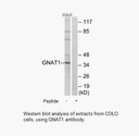 Product image for GNAT1 Antibody