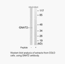 Product image for GNAT2 Antibody