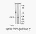 Product image for HOXD10 Antibody