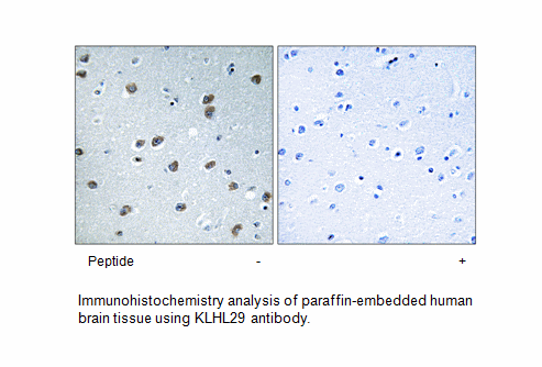 Product image for KLHL29 Antibody