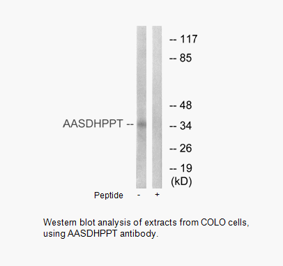 Product image for AASDHPPT Antibody