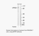 Product image for CEP97 Antibody