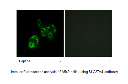 Product image for SLC27A4 Antibody