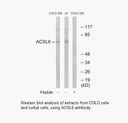 Product image for ACSL6 Antibody