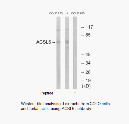 Product image for ACSL6 Antibody