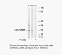 Product image for LDLRAD1 Antibody