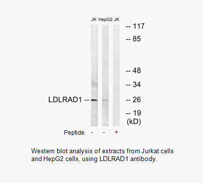 Product image for LDLRAD1 Antibody