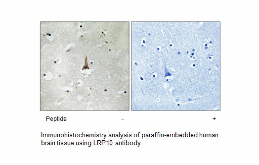 Product image for LRP10 Antibody