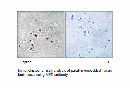 Product image for MED13L Antibody