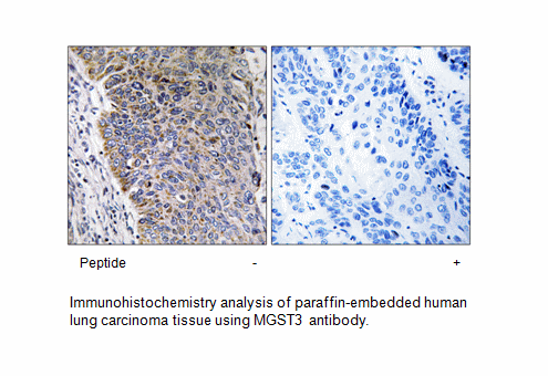 Product image for MGST3 Antibody