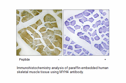 Product image for MYH4 Antibody