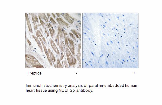Product image for NDUFS5 Antibody
