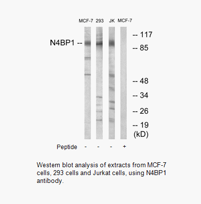 Product image for N4BP1 Antibody