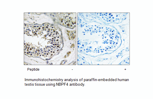 Product image for NBPF4 Antibody