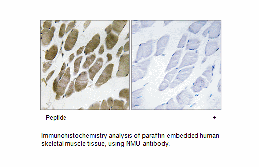 Product image for NMU Antibody