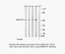 Product image for CHRNA10 Antibody