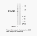 Product image for POM121 Antibody