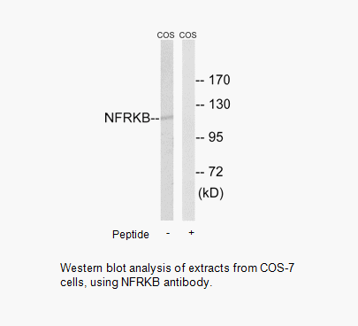 Product image for NFRKB Antibody