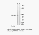 Product image for PPP1R8 Antibody