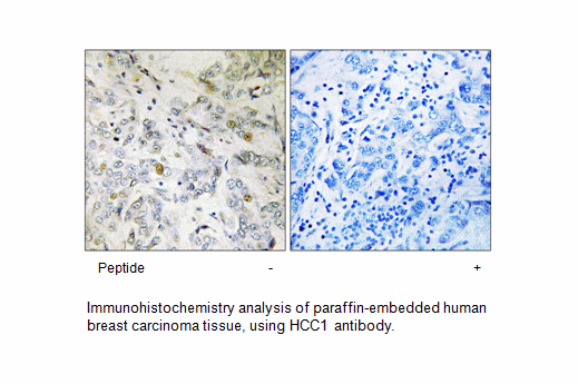 Product image for HCC1 Antibody
