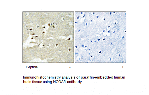 Product image for NCOA5 Antibody