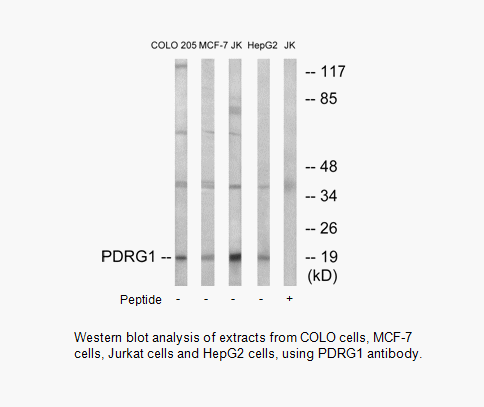 Product image for PDRG1 Antibody