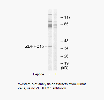 Product image for ZDHHC15 Antibody