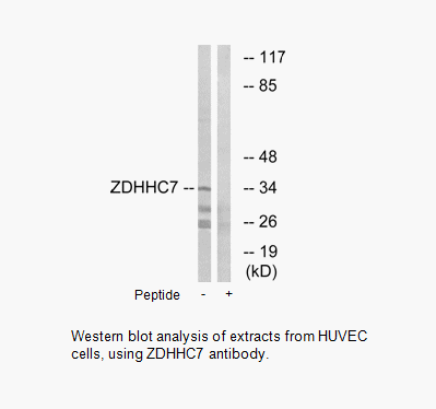 Product image for ZDHHC7 Antibody