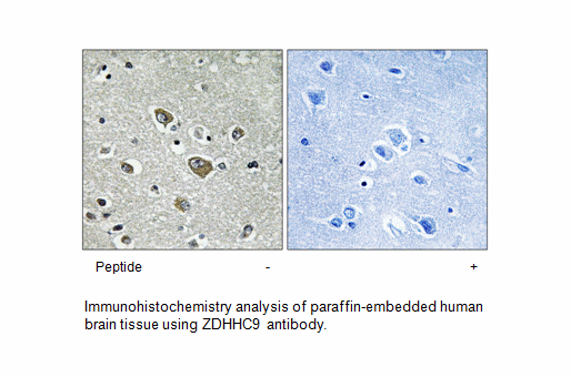 Product image for ZDHHC9 Antibody