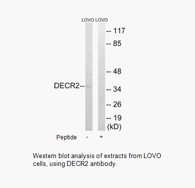 Product image for DECR2 Antibody