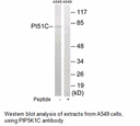 Product image for PIP5K1C Antibody