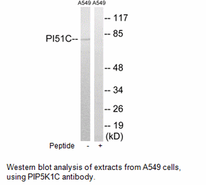 Product image for PIP5K1C Antibody