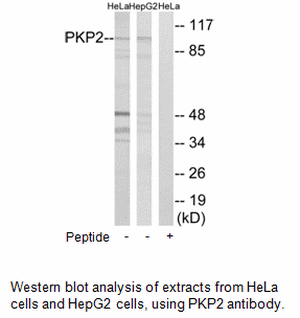 Product image for PKP2 Antibody