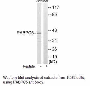 Product image for PABPC5 Antibody
