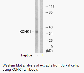 Product image for KCNK1 Antibody