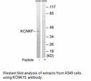Product image for KCNK15 Antibody
