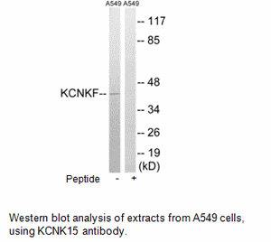 Product image for KCNK15 Antibody