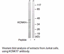 Product image for KCNK17 Antibody