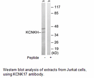 Product image for KCNK17 Antibody