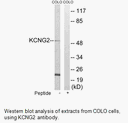Product image for KCNG2 Antibody
