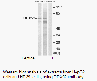 Product image for DDX52 Antibody