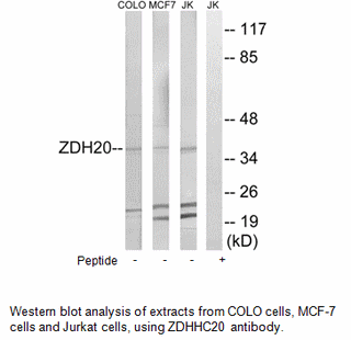 Product image for ZDHHC20 Antibody