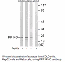 Product image for PPP1R14D Antibody