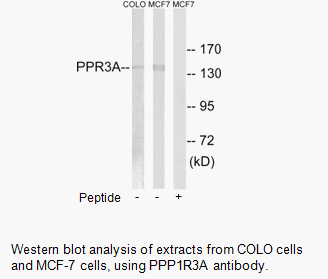 Product image for PPP1R3A Antibody