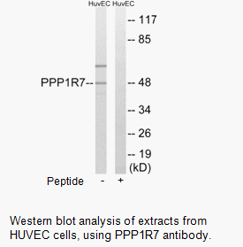 Product image for PPP1R7 Antibody
