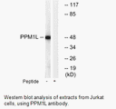 Product image for PPM1L Antibody